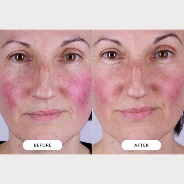 CurrentBody Skin LED Light Therapy Mask: Series 2 - Image 5