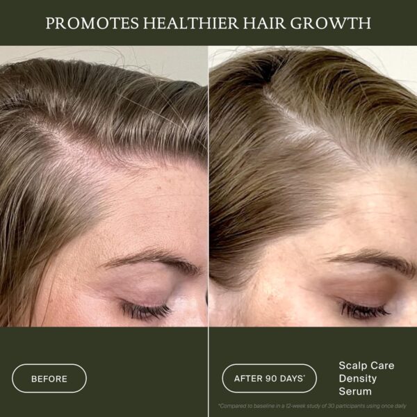Living Proof Scalp Care Density Serum - Image 3