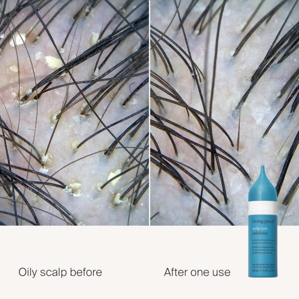Living Proof Scalp Care Exfoliator - Image 2